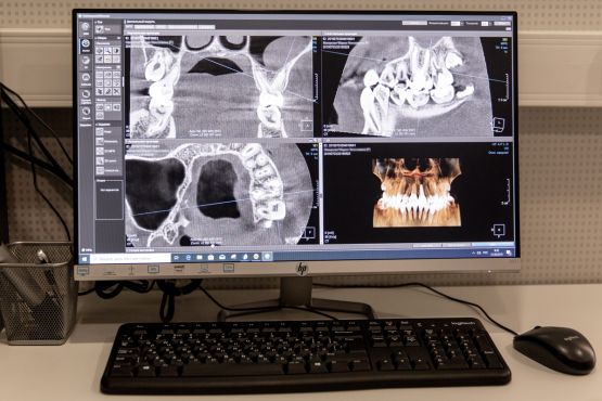 Дентальный компьютерный томограф KaVo Pan eXam Plus 3D Дентальный компьютерный томограф KaVo Pan eXam Plus 3D