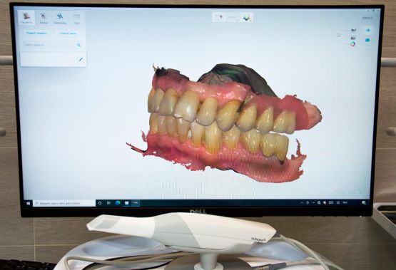 Дентальный 3D сканер 3D Shape Дентальный 3D сканер 3D Shape